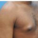 It’s abnormal for men to have big breasts – HEARD VOICE NEWS ONLINE