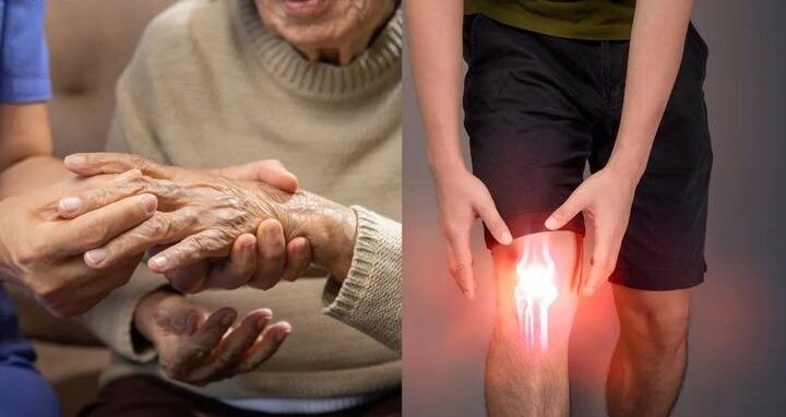 Just Knee Pain Or Arthritis Pain: Expert Lists Factors To Differentiate Between Both