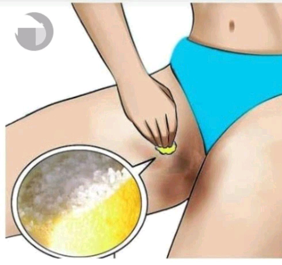 Ladies, If Your Inner Thighs Are Dark See Easy Ways You Can Lighten Them