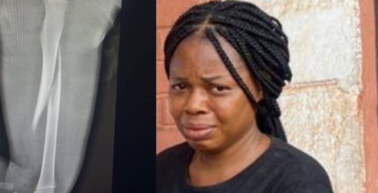 Woman Remanded In Prison For Br£aking 3-Year-Old Stepson’s L£g With Pestle – HEARD VOICE NEWS ONLINE